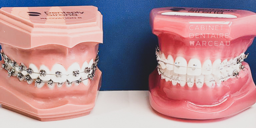Orthodontie dentaire Miroirs double face Réflecteur Dentisterie